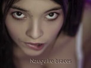 Nauguire_braces